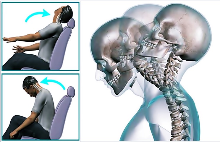 Composición gráfica de un hombre afectado por un movimiento brusco en un sillón de automóvil. 